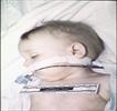 Autopsy Photo 2