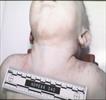 Autopsy Photo 5