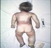 Autopsy Photo 6