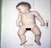 Autopsy Photo 7