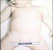 Autopsy Photo 8