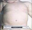 Autopsy Photo 9