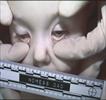 Autopsy Photo 10