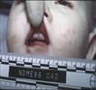 Autopsy Photo 12